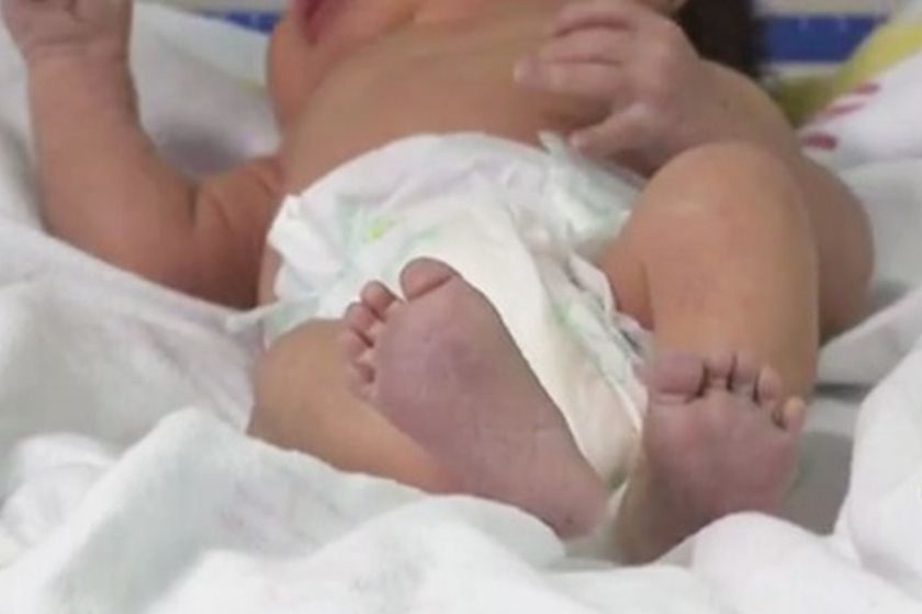 Bebê de 02 meses morre engasgada com o próprio vômito Foto97239