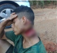 Jovem é encontrado "semi decapitado", mas consciente Foto52806