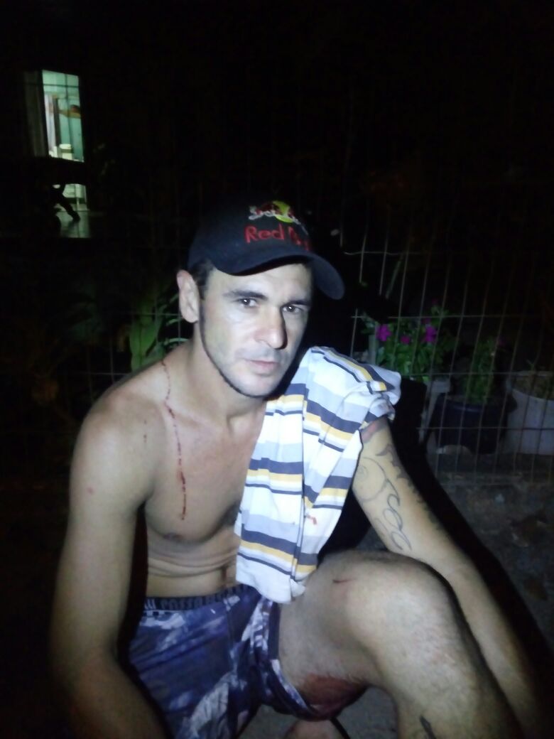 Dupla em moto atira e deixa homem ferido no pescoço Foto34076