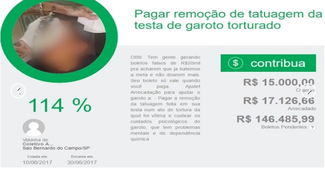 Rapaz arrecada bolada para tirar tatuagem da testa Foto27488
