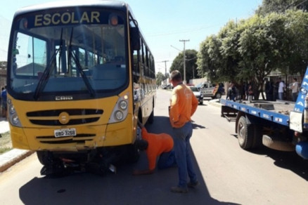 Estudante de arquitetura tem perna amputada após acidente Foto41581