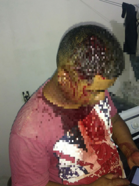 Agente socioeducativo é atacado na rua e tem a cabeça "aberta a pedradas" Foto97650