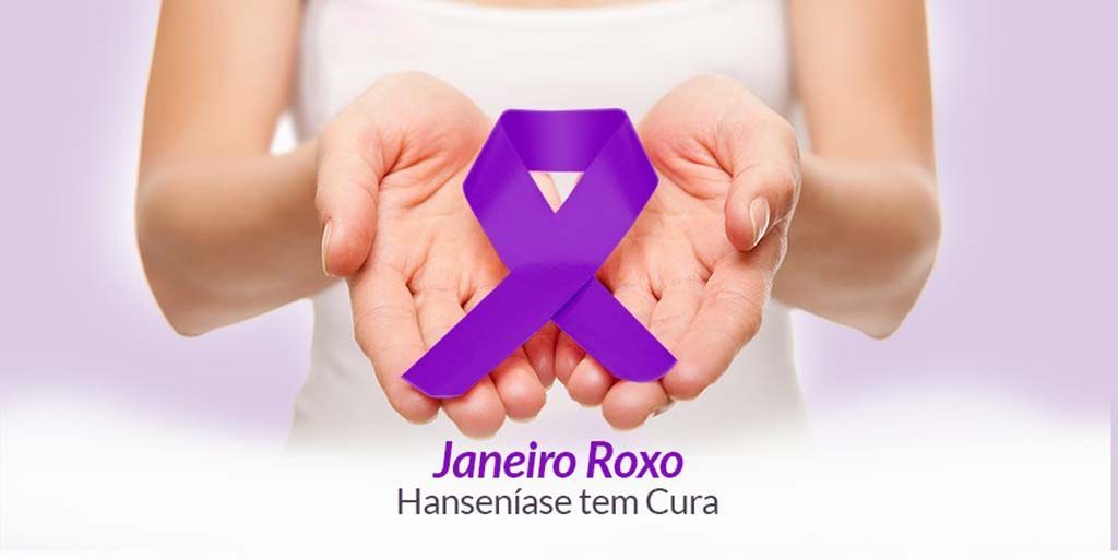 Saúde reforça ações voltadas ao Janeiro Roxo mês de Combate e Prevenção da Hanseníase em Sorriso Foto76595