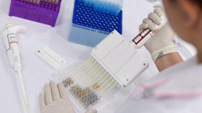 Brasil participa de testes de duas vacinas promissoras contra o novo coronavírus Foto94531