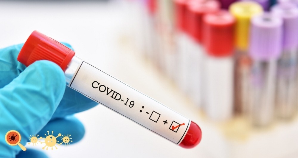 Sorriso e mais 12 municípios estão com risco moderado de contaminação pela covid Foto11496