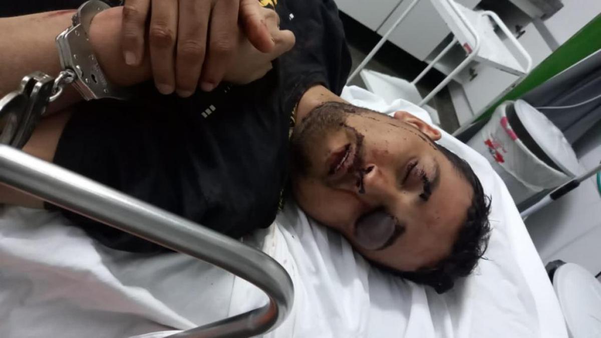 Vereador envolvido em furto de gado está em coma e seu estado é "gravíssimo" Foto50541