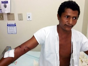 Marido pode ter se ferido pela hélice de barco e não por jacaré, diz laudo Foto80587