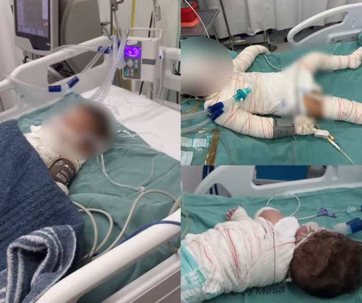 Criança de 3 anos morre após explosão de churrasqueira que matou irmão e deixou mãe em estado grave Foto72941