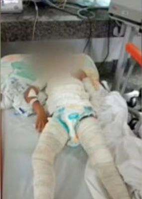 Criança de 1 ano morre com queimaduras no corpo após botijão de gás explodir Foto60278
