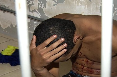 Jovem é preso suspeito de tentar injetar pimenta no útero da namorada por não aceitar gravidez Foto11675