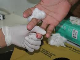 Estado inicia campanha de prevenção contra Hepatites Virais Foto97897