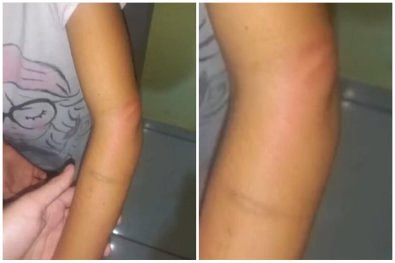 Mãe é presa após torturar filho de 2 anos e mandá-lo à escola com braço quebrado Foto25525