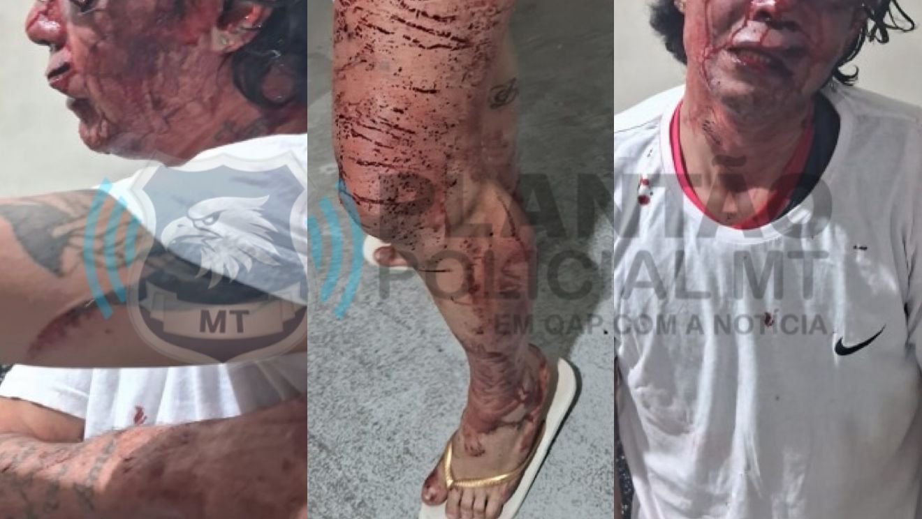 Detento fica ferido após agressão de companheiro de cela na Penitenciária Ferrugem, em Sinop Foto83217