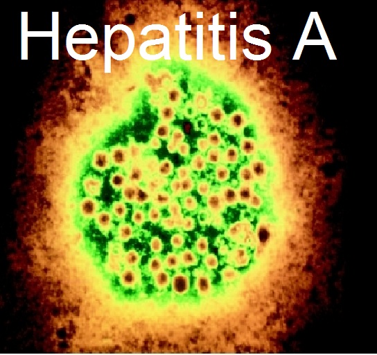 Vírus da hepatite A é detectado em água fornecida em MT Foto26692