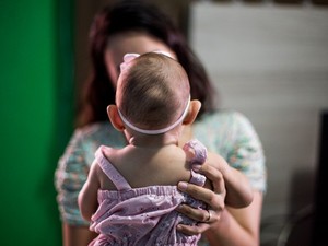 Treze municípios de Mato Grosso têm casos confirmados de microcefalia Foto77276
