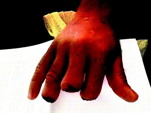 Foto37099
